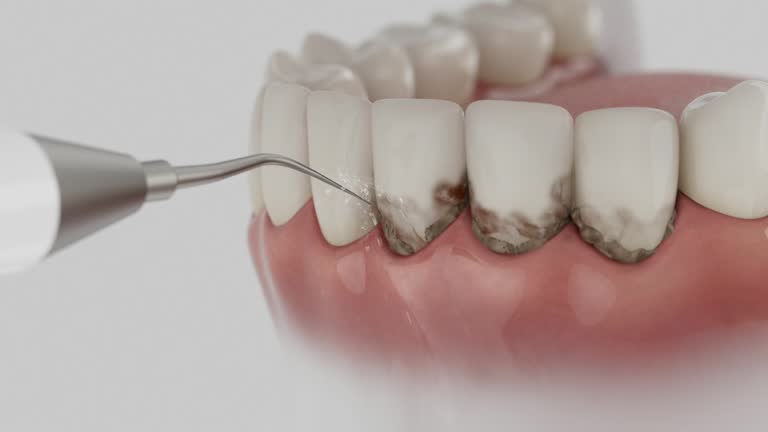 Trusted Tooth Extraction service in Urbana, MD - Dentist Open Now
